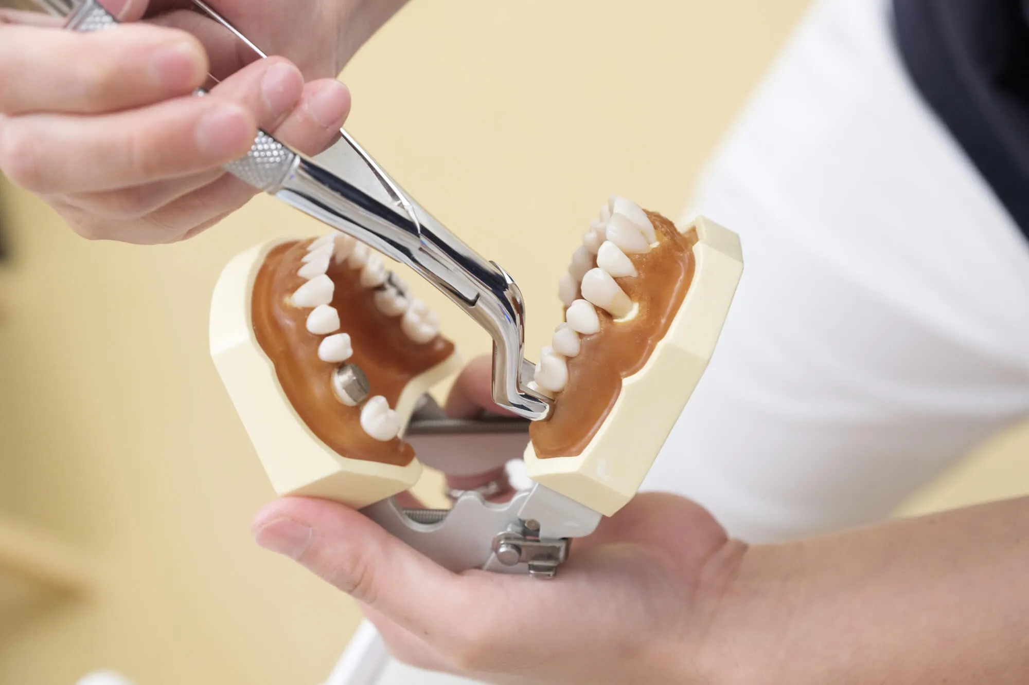 Denville Dentist demonstrated an extraction