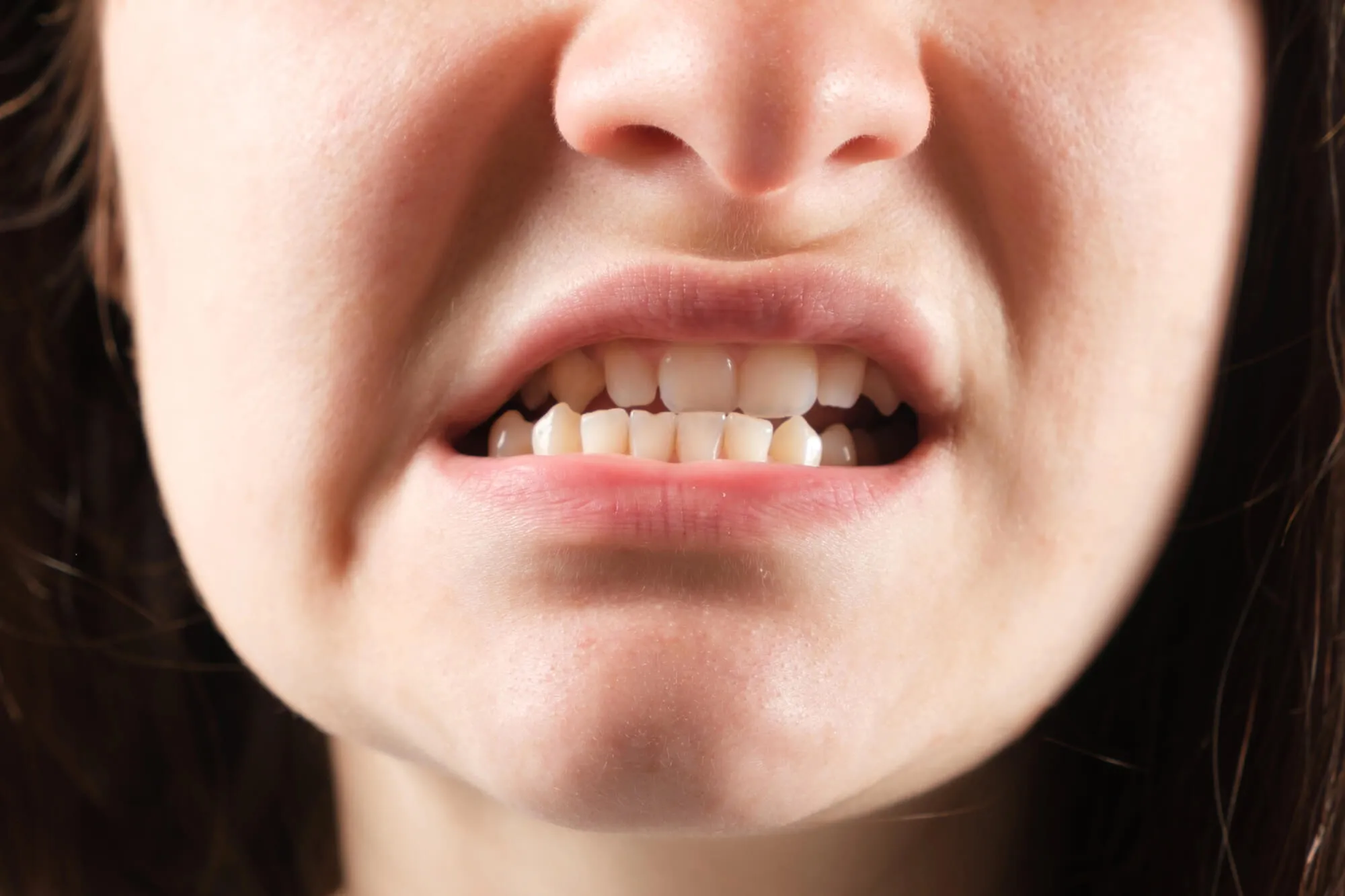 woman with TMJ Denville NJ symptoms