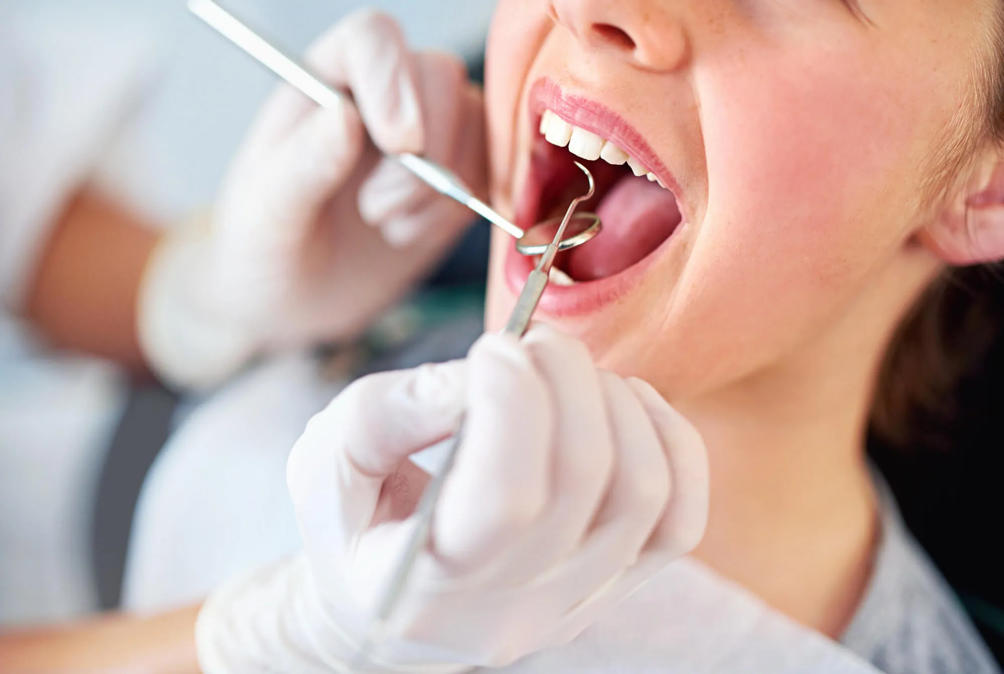 General Dentist Denville NJ examines teeth