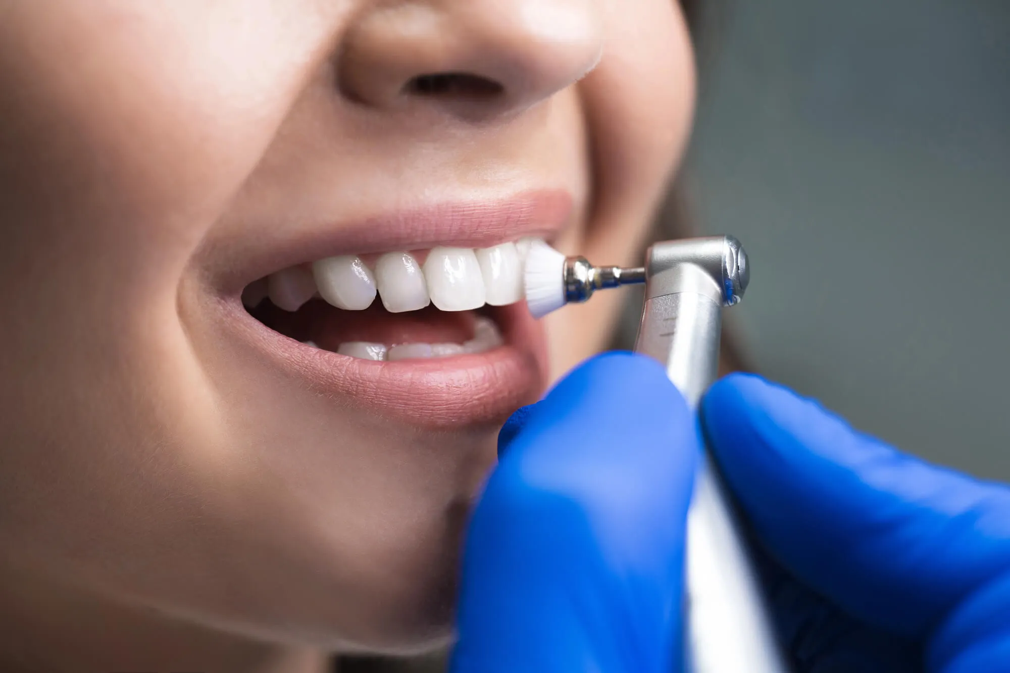 General Dentist Denville NJ performing routine cleaning
