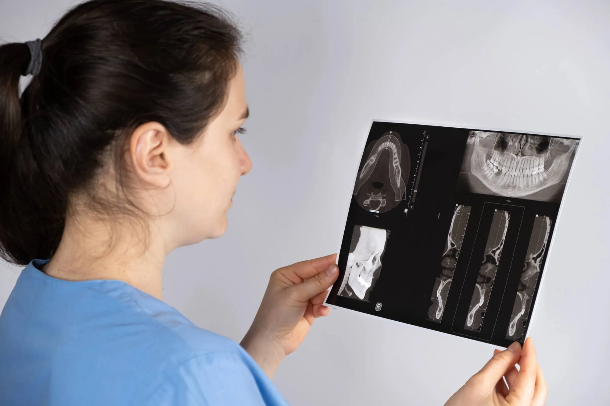 doctor studying TMJ Treatment Denville NJ