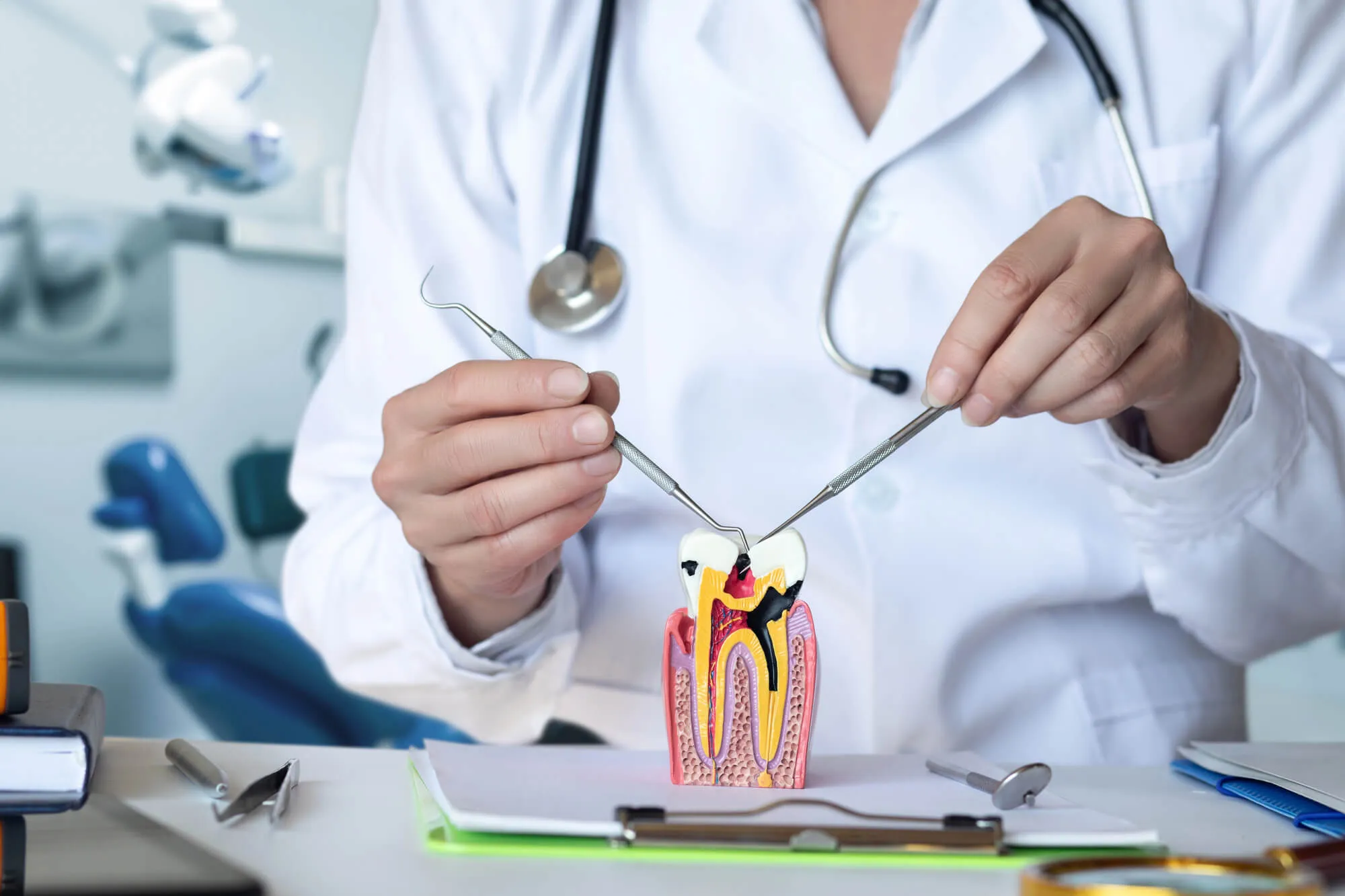 Root Canal Specialist Denville NJ holding a tooth model