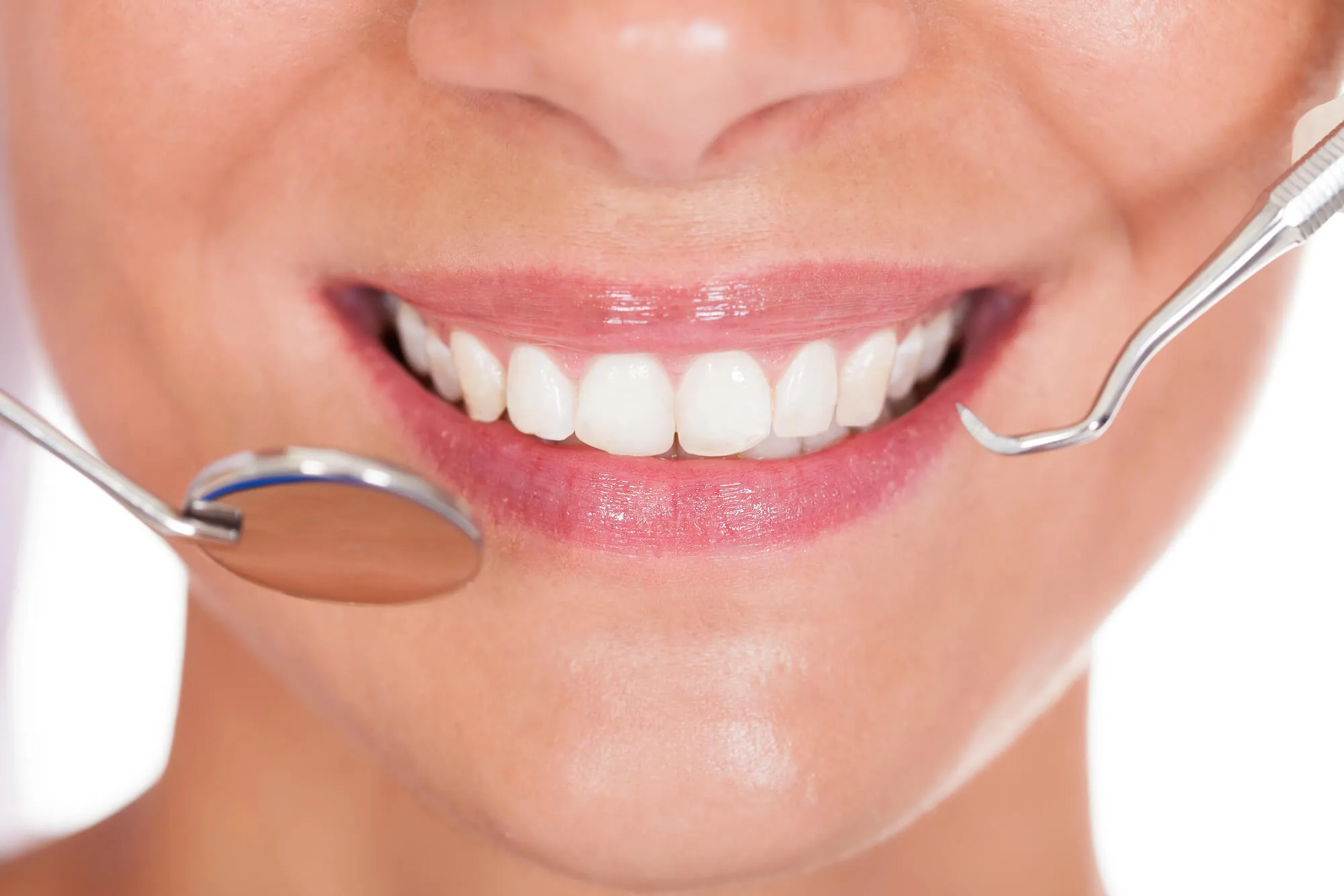 Is Professional Teeth Whitening Worth It?